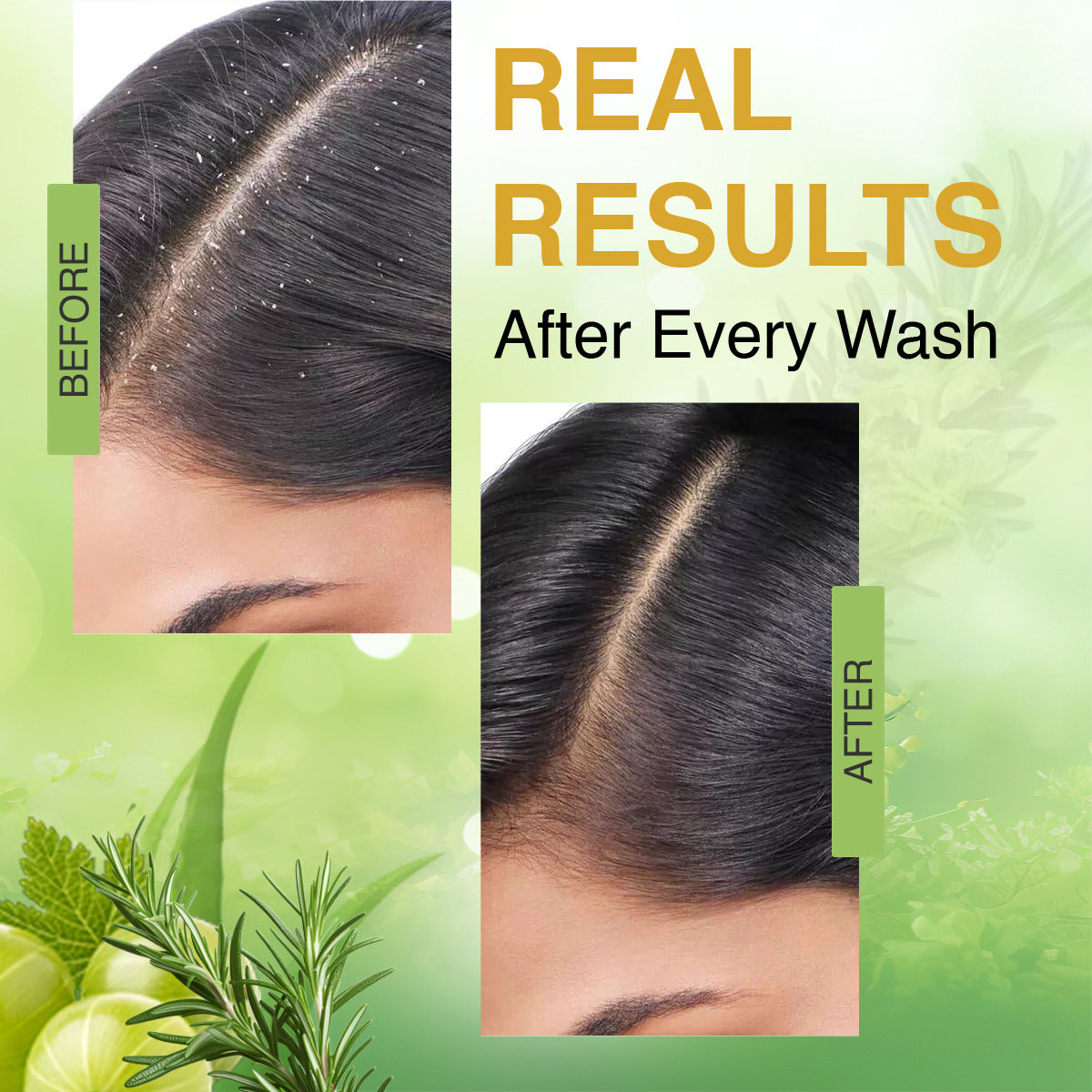 Keshkulp Keratin Shampoo - 150ml  Anti-Hair Fall & Dandruff Solution  (Pack of 1)