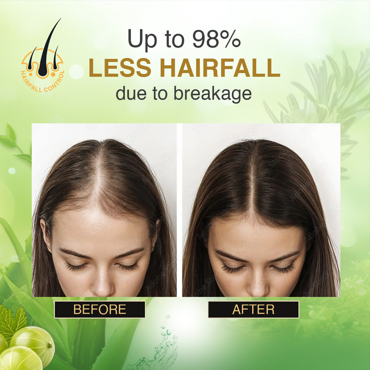 Keshkulp Keratin Shampoo - 150ml  Anti-Hair Fall & Dandruff Solution  (Pack of 1)